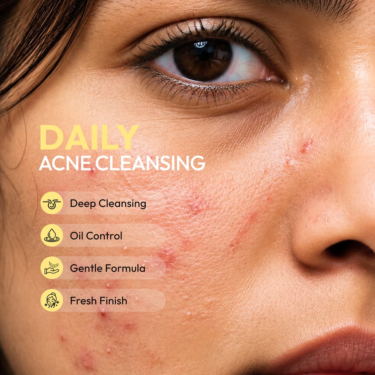 Acnifresh Face Wash — view 4